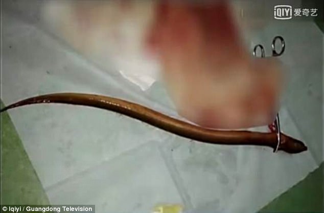 Chinese chef eel anus